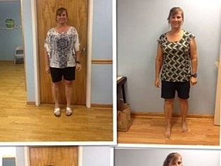 Losing Weight Before and After Pic