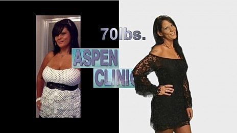 I Lost 70 lbs Weight Loss Before and After Picture