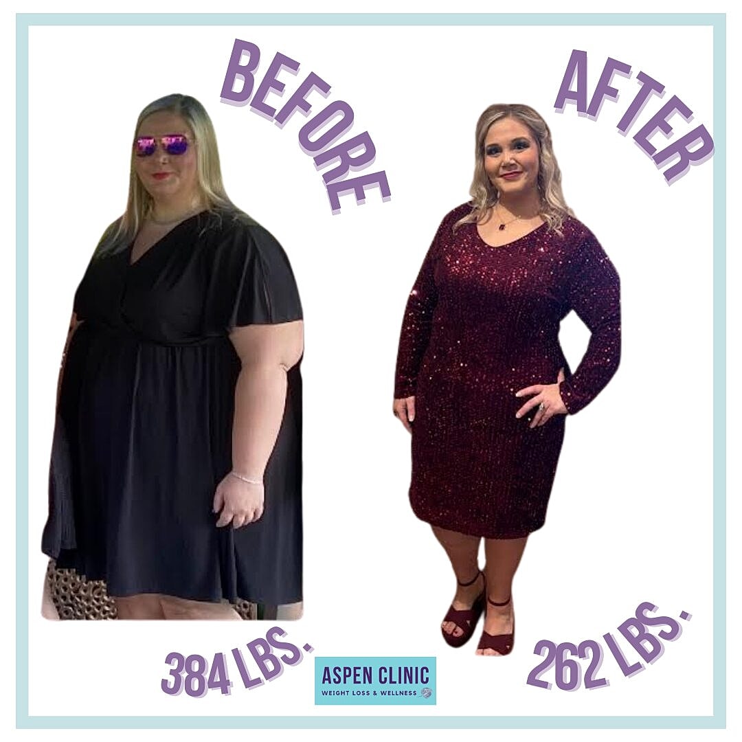Weight Loss Before and After Pictures Before & After