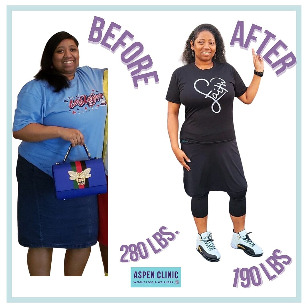 Weight Loss Before and After Pictures Before & After