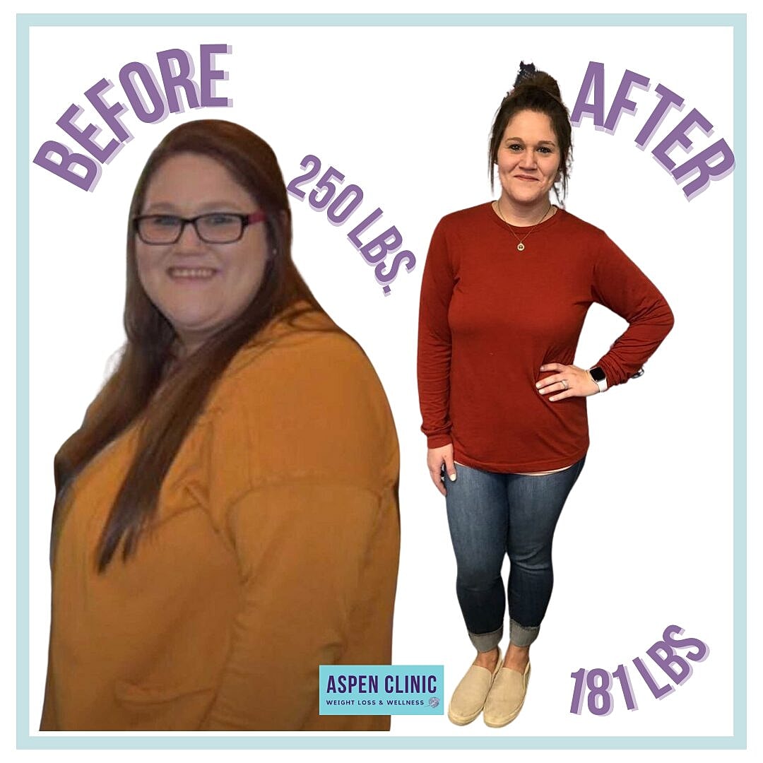 Weight Loss Before and After Pictures Before & After