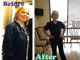 Weight Loss Before and After Picture
