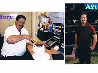 Weight Loss Before and After Picture