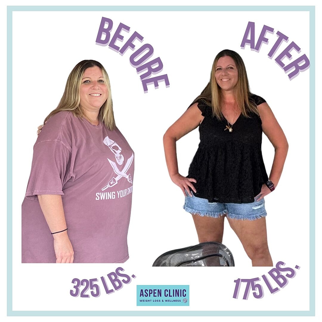 Weight Loss Before and After Pictures Before & After