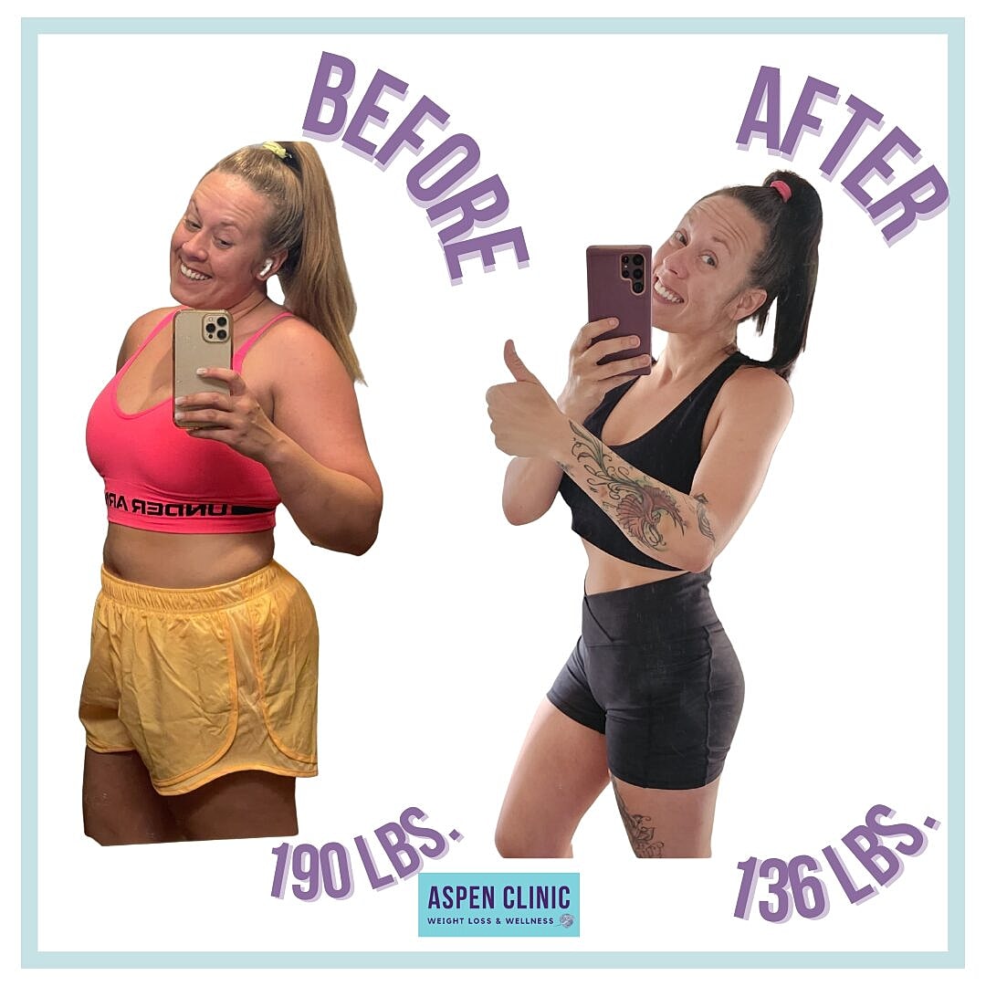 Weight Loss Before and After Pictures Before & After