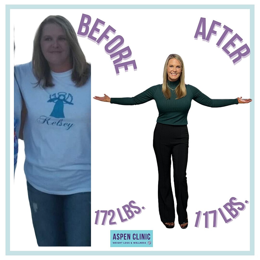 Weight Loss Before and After Pictures Before & After