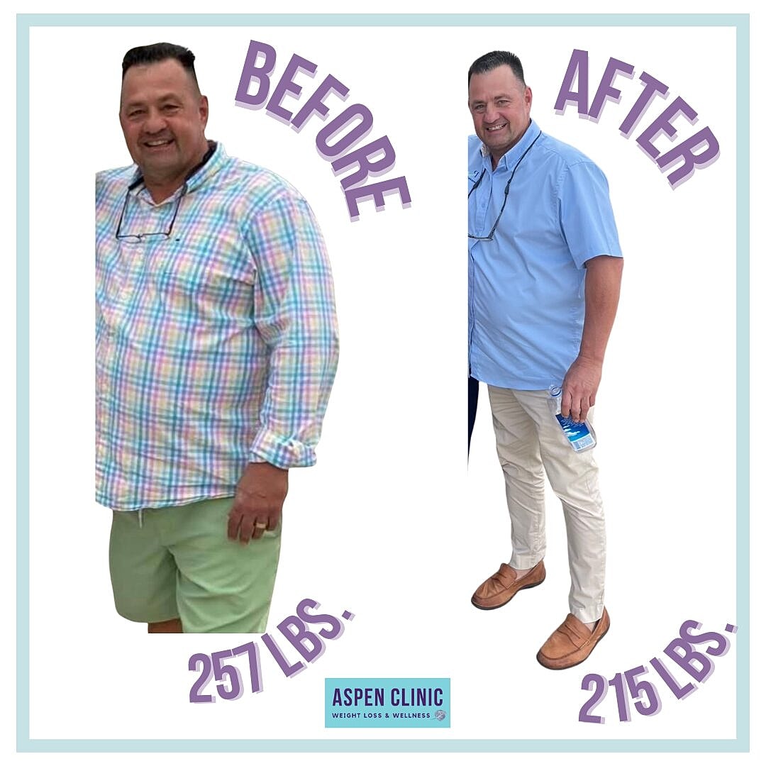 Weight Loss Before and After Pictures Before & After