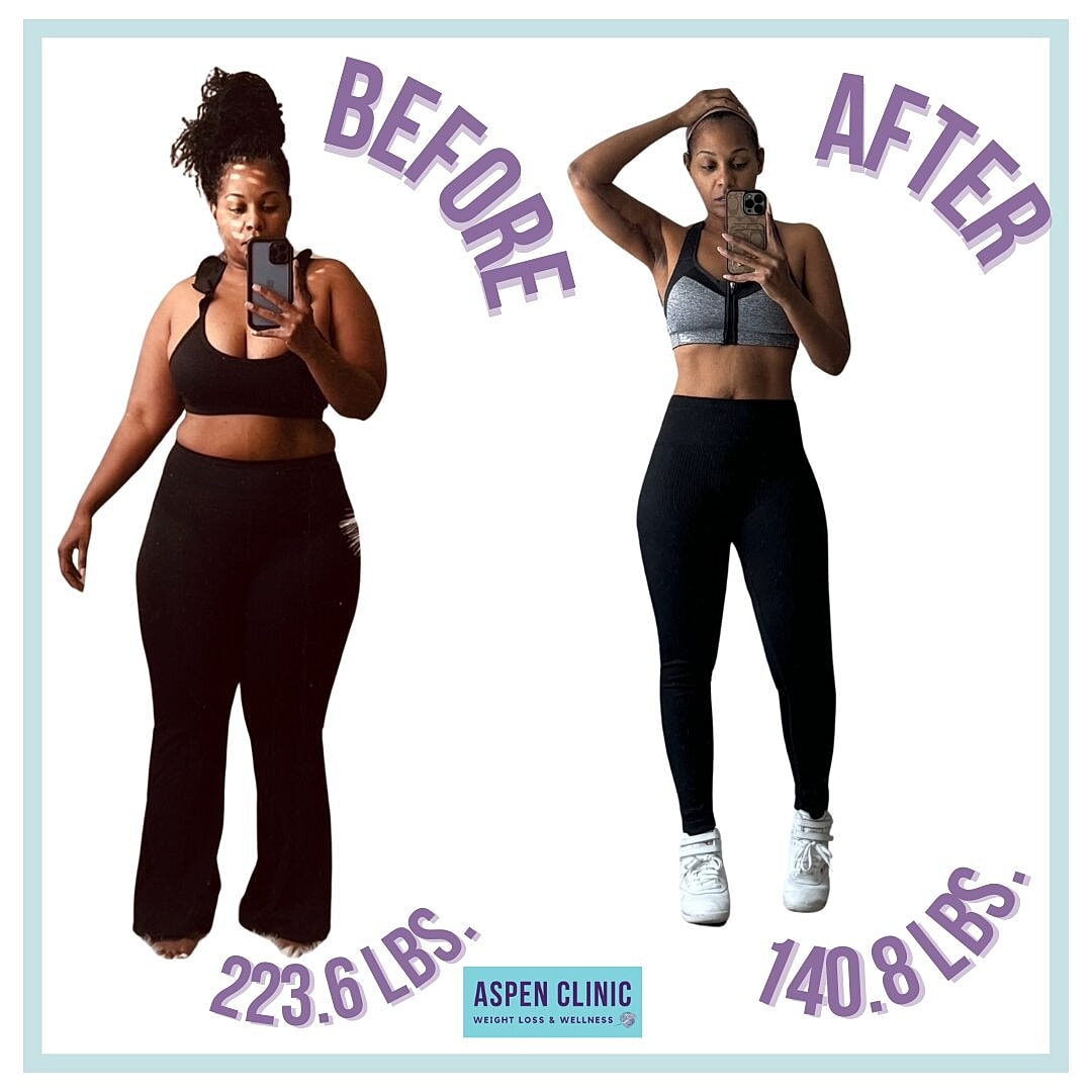 Weight Loss Before and After Pictures Before & After