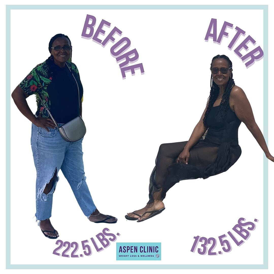Weight Loss Before and After Pictures Before & After