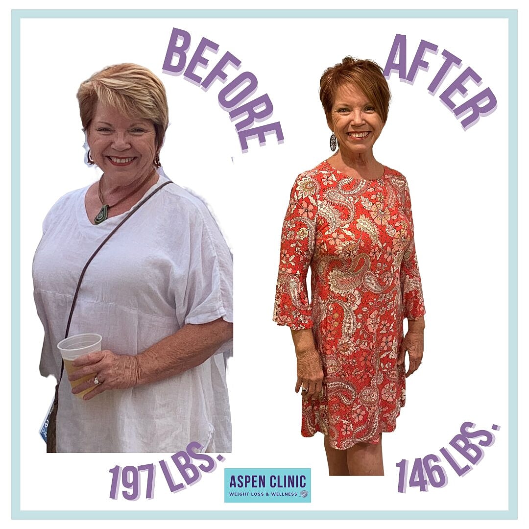 Weight Loss Before and After Pictures Before & After