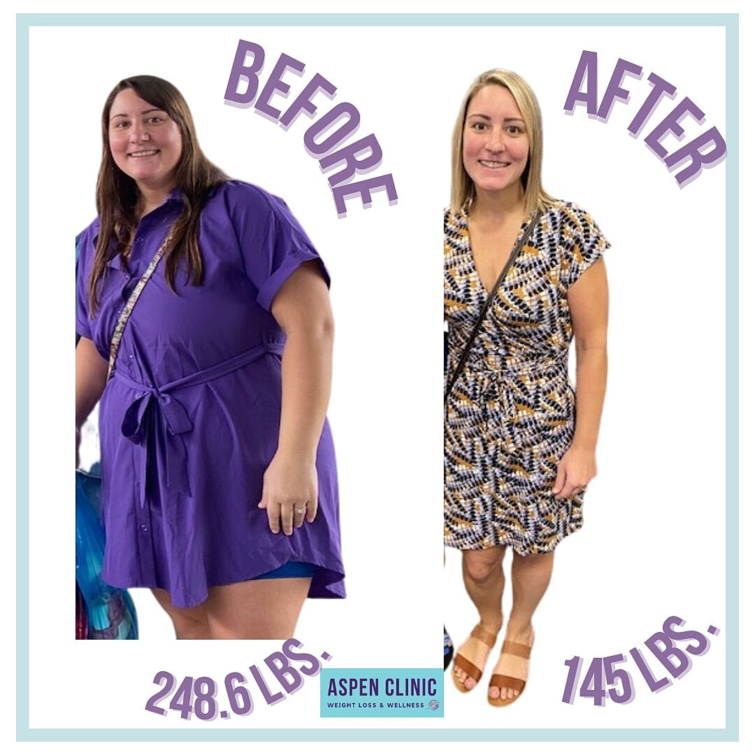 Weight Loss Before and After Pictures Before & After