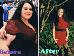 Weight Loss Before and After Picture